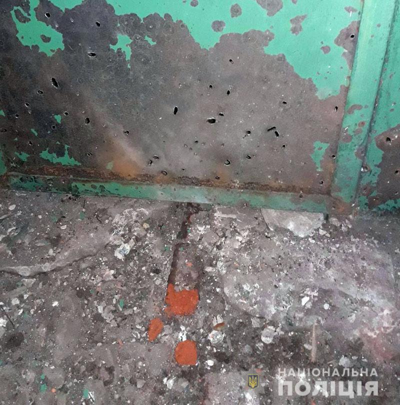 На Донеччині мирний житель потрапив під обстріл бойовиків. Наразі він перебуває в лікарні