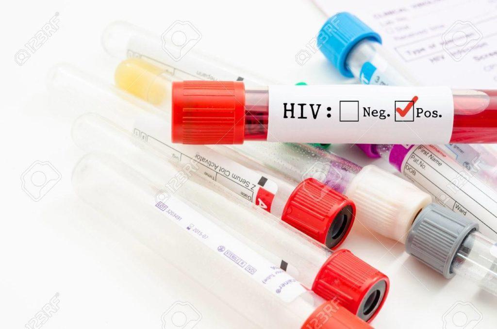 Бахмутська ОТГ закупить для інфікованих ВІЛ/СНІД медикаменти та експрес-тести для містян