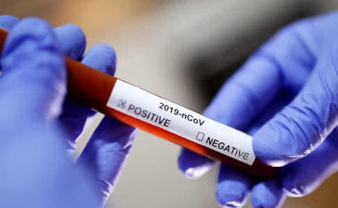 Благодійники передали військовим медикам на Донбасі експрес-тести на коронавірус (ВІДЕО)