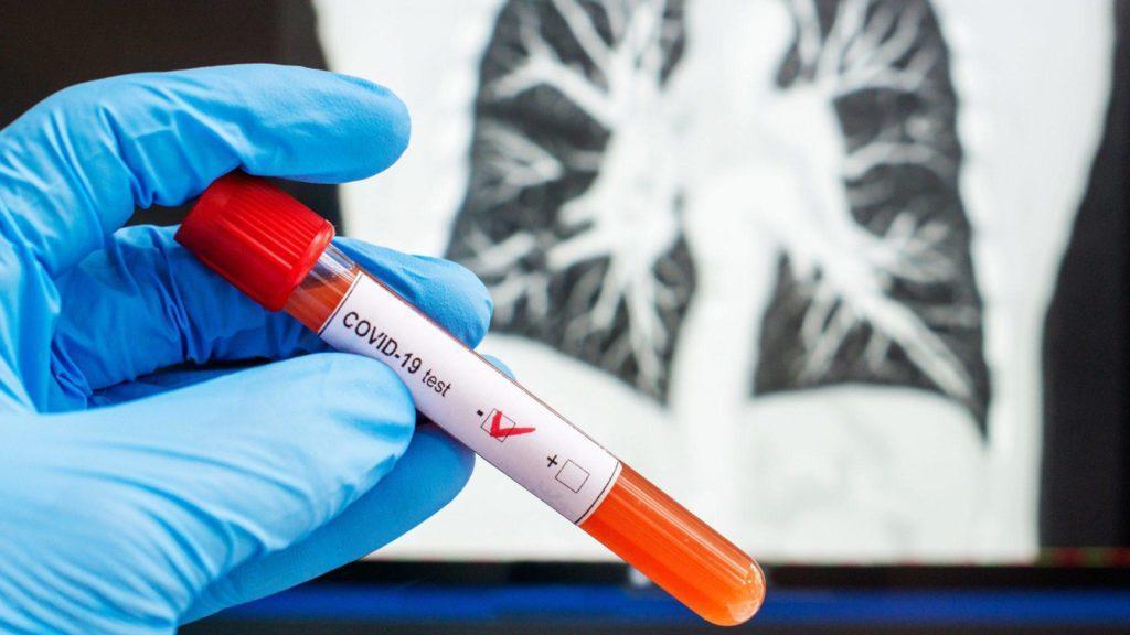 На Донеччині за добу коронавірус підтвердили у ще 25 людей. 3 пацієнти з Бахмута