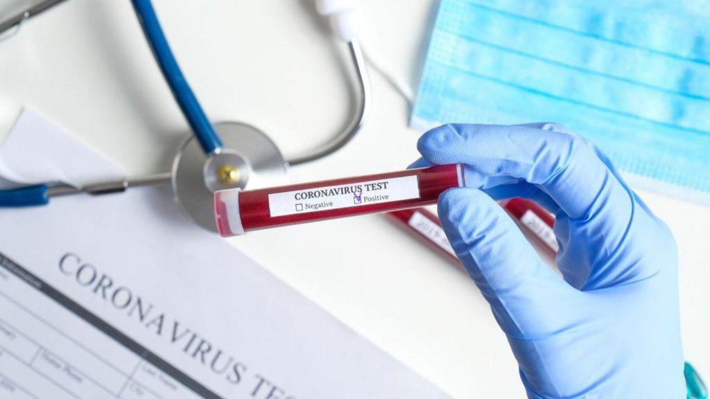 В Україні коронавірус підтвердили у більш ніж 2 тисяч людей, – МОЗ