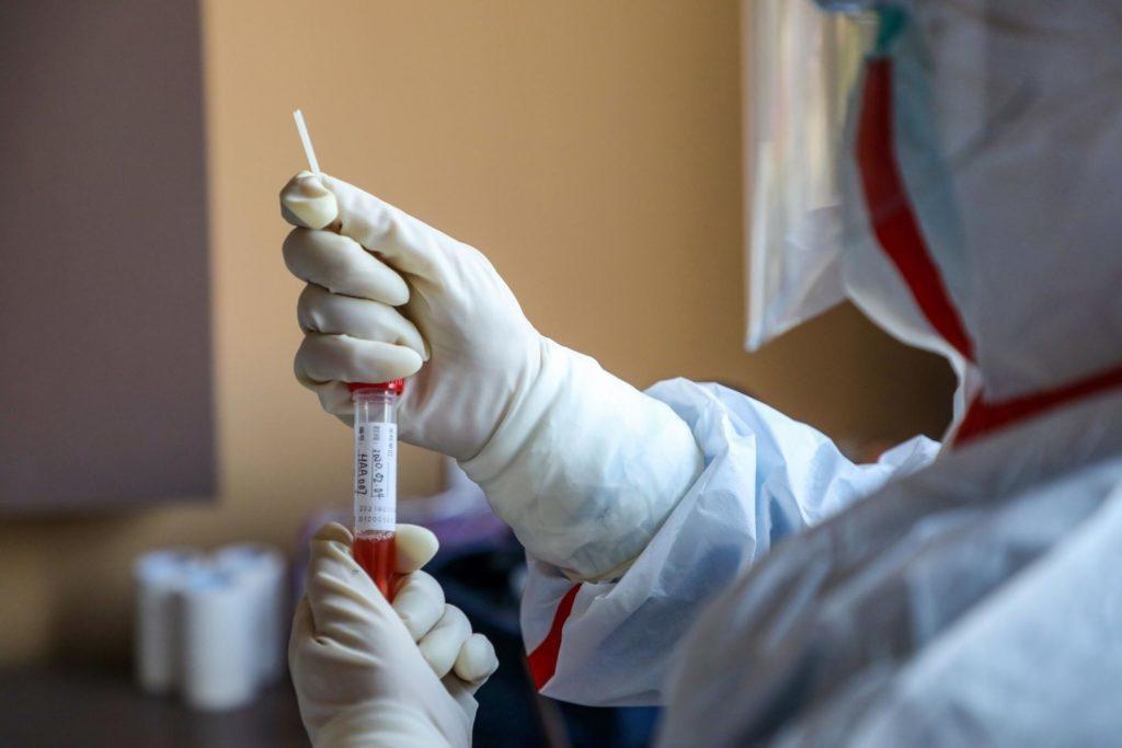 На Донбасі лабораторно перевірили на коронавірус найменше людей
