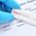 “Я тестуюся на коронавірус щодня”. Навіщо гуммісії експрес-тести та як протестувати себе (монолог)