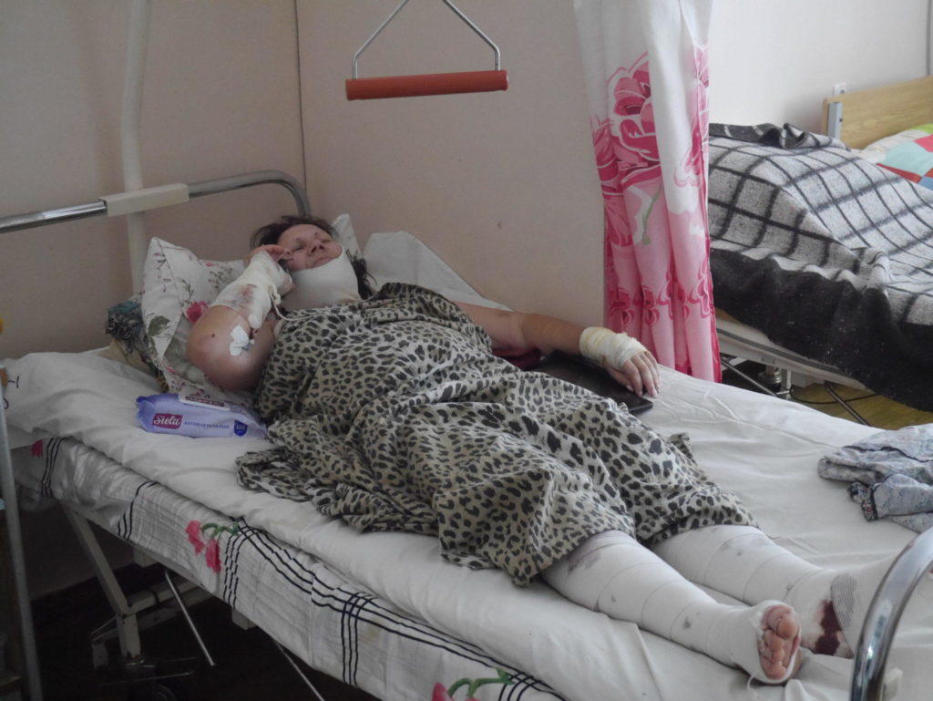 Як почувається після третього нападу експолонена т.зв. “ДНР” Валентина Бучок (фото)