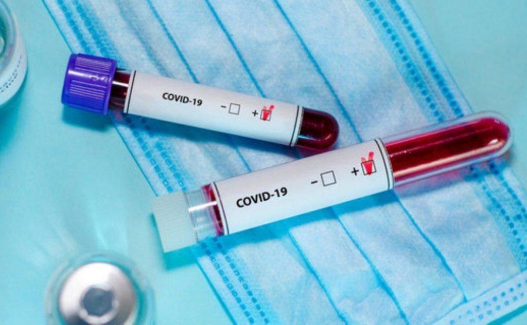 У Бахмуті – новий пацієнт з коронавірусом. В підконтрольних районах області їх загалом 5