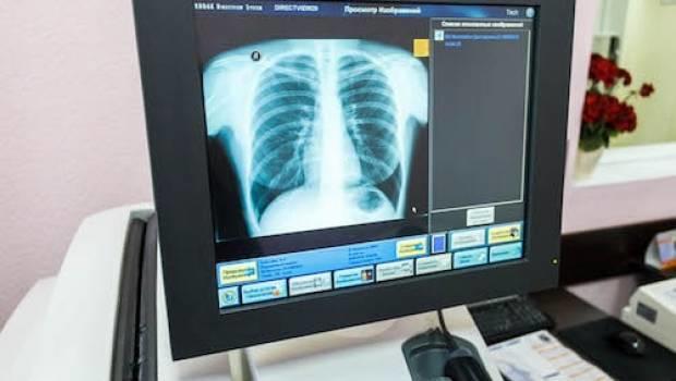 Часовоярська лікарня отримала сучасний цифровий рентгенапарат