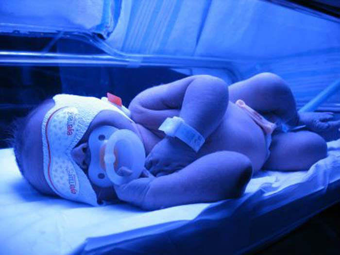 В пологовому Бахмута отримали нове обладнання і зможуть краще виходжувати недоношених немовлят