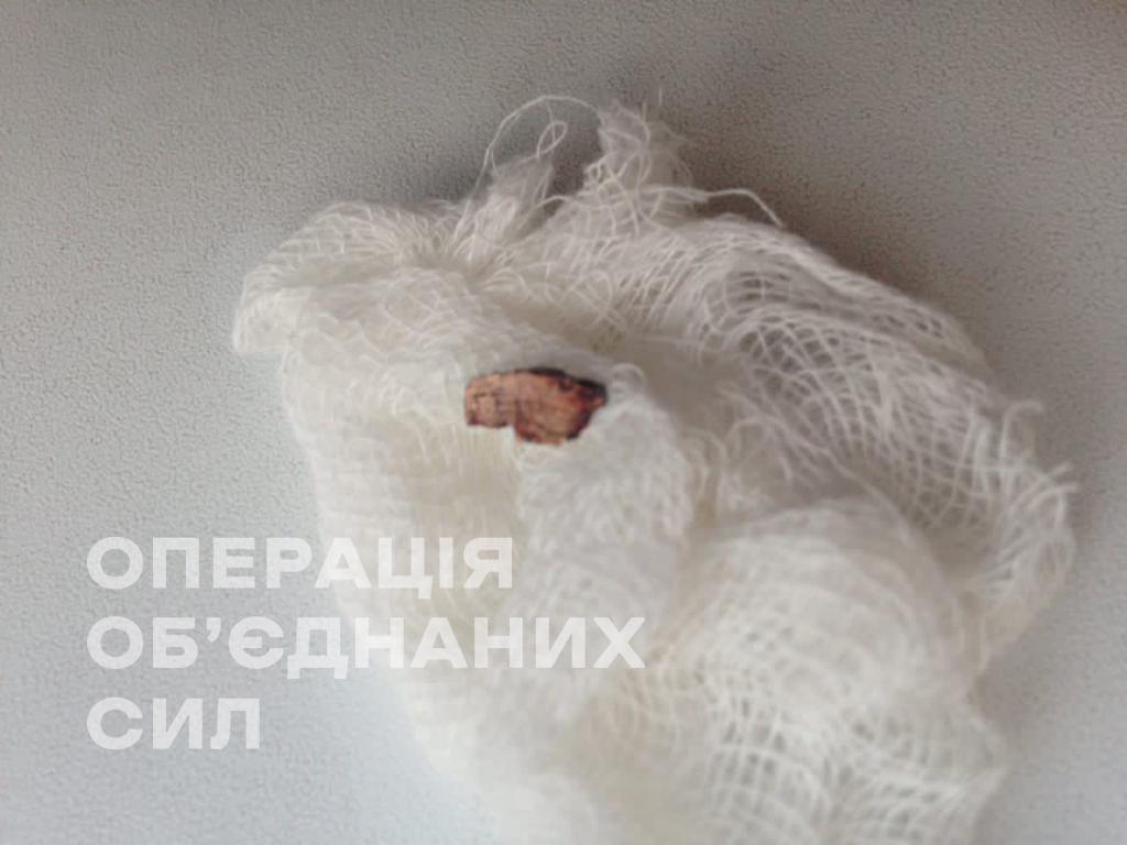 На Донбасі 120-мм міна влучила в будинок, поранений господар (фото) 1