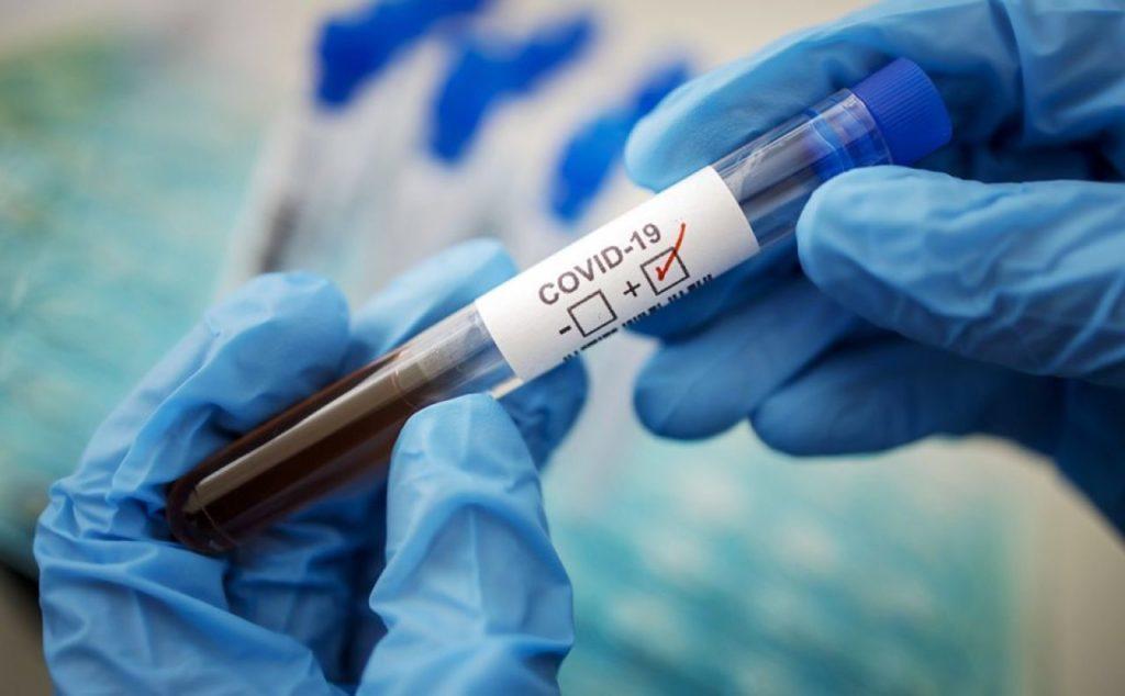 За день врачи Донетчины подтвердили почти 700 пациентов с коронавирусом