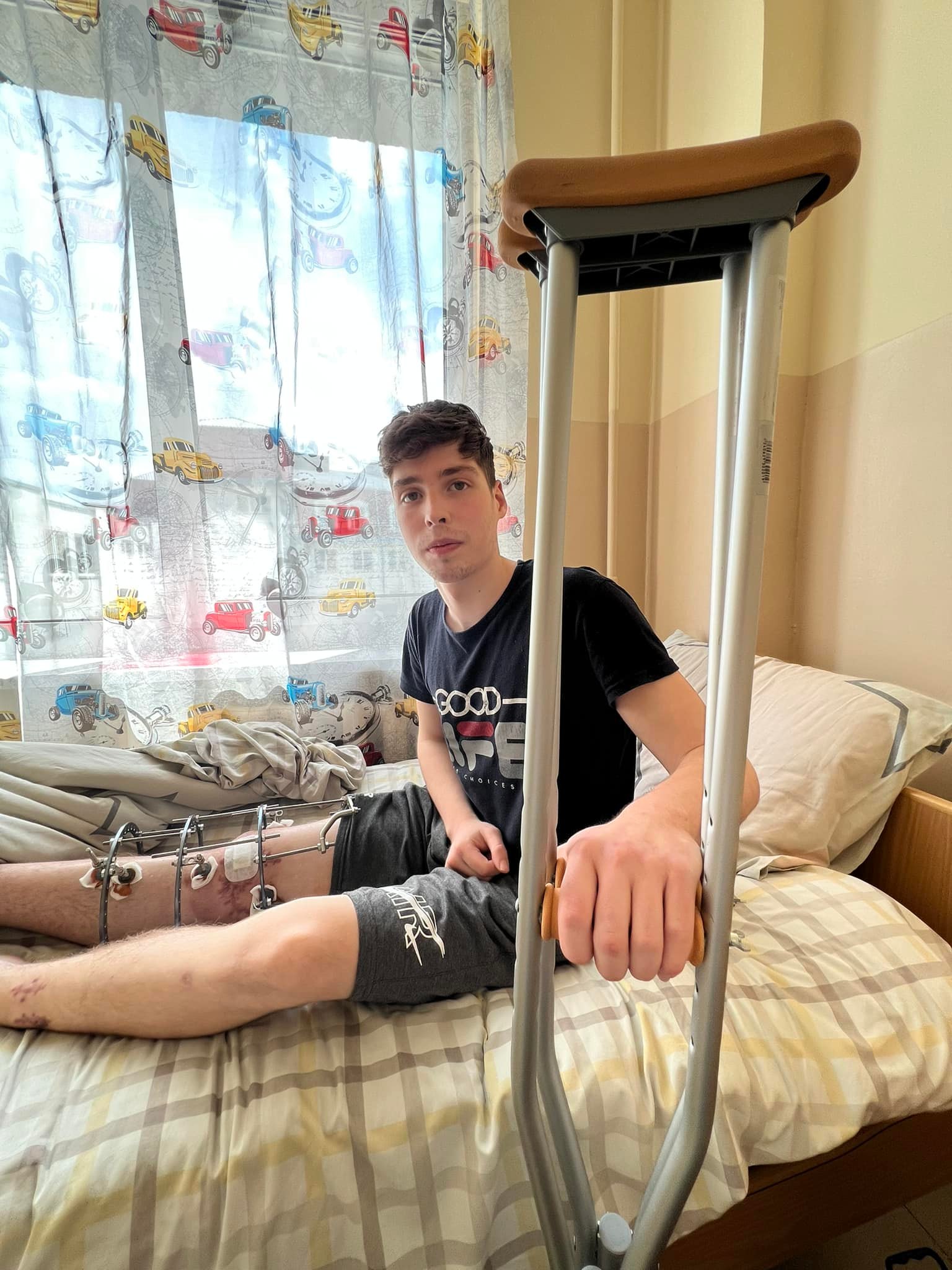 Чуть не потерял ногу из-за захватчиков. 17-летний волонтер из Северодонецка получит коленные протезы 2