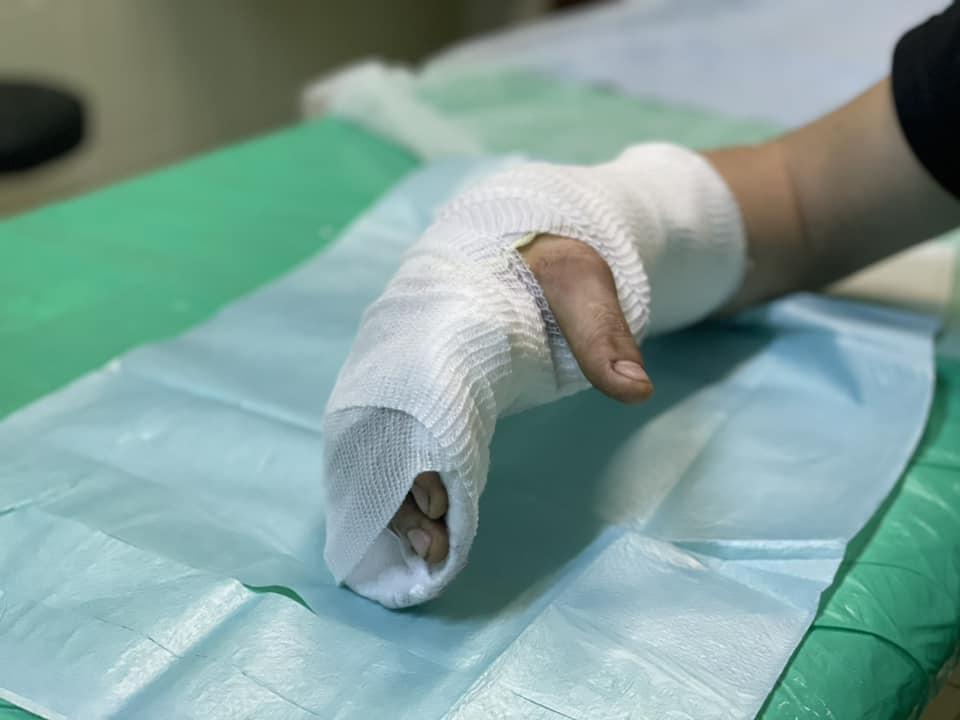 Підлітка з Бахмута лікують у Львові після російського обстрілу
