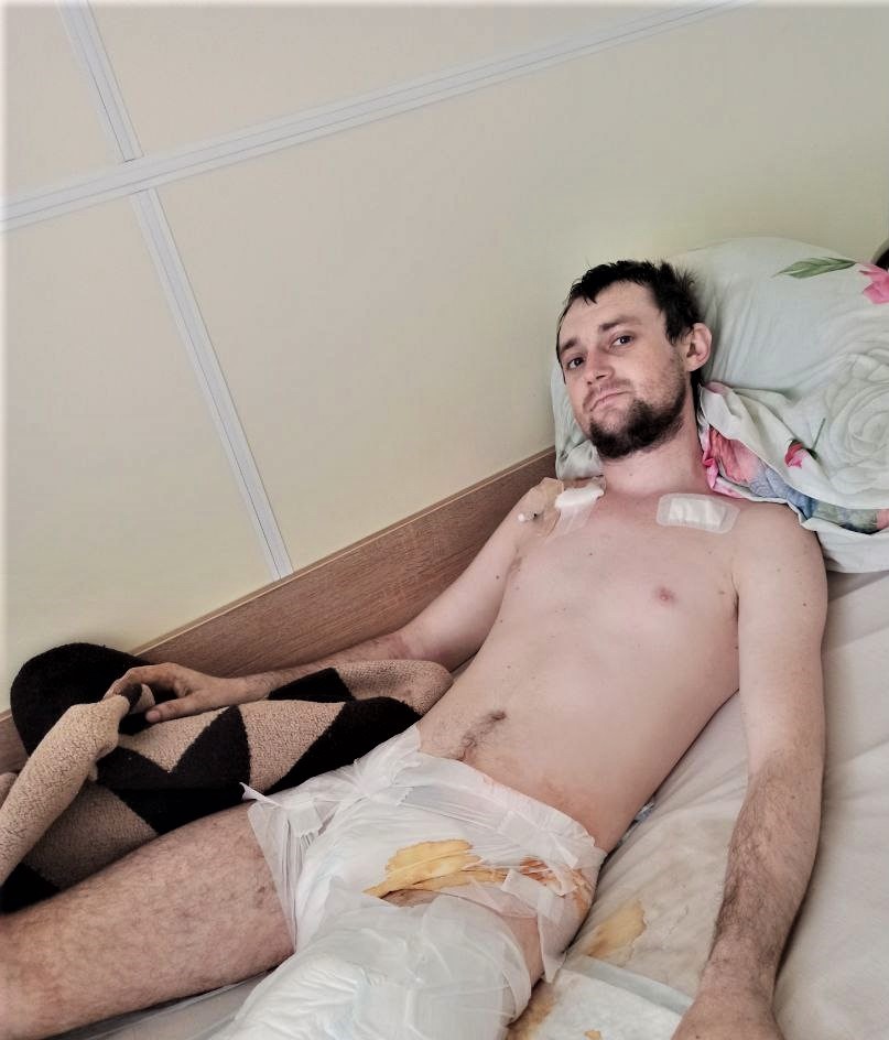 елекромонтер Євген Перепелиця з Луганщини після операції