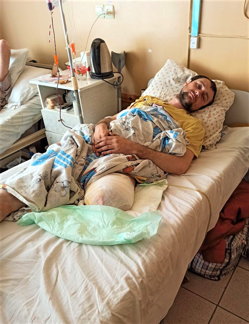 електрик Євген Перепелиця у лікарні після ампутації
