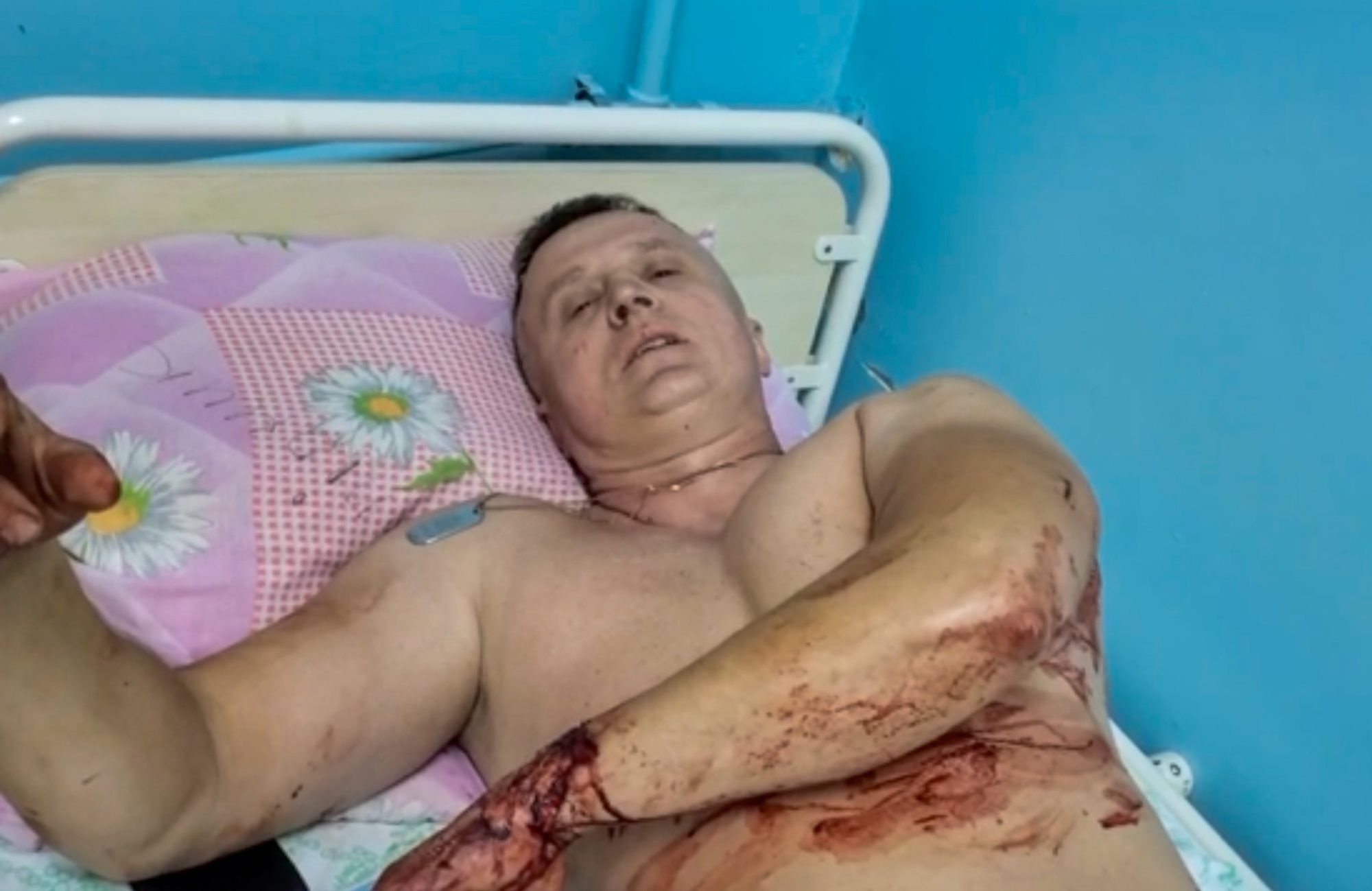В каком состоянии пострадавшие от атаки по Покровску и как им помочь 4