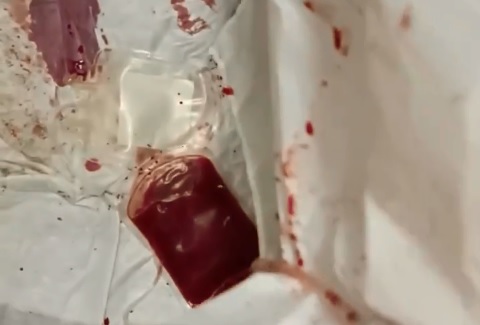Залог выживания бойцов: Боевым медикам разрешили переливать кровь на фронте