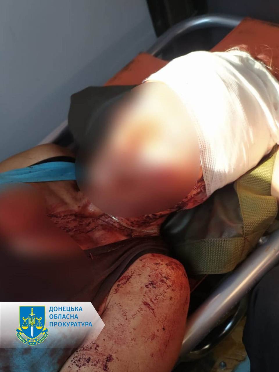 Россияне обстреляли Торецк: ранена 59-летняя женщина, ее увезли в больницу (ФОТО) 1