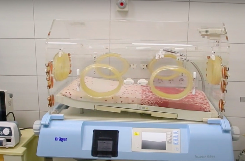 У Покровському перинатальному центрі запрацювало оновлене відділення  виходжування та реабілітації новонароджених 2
