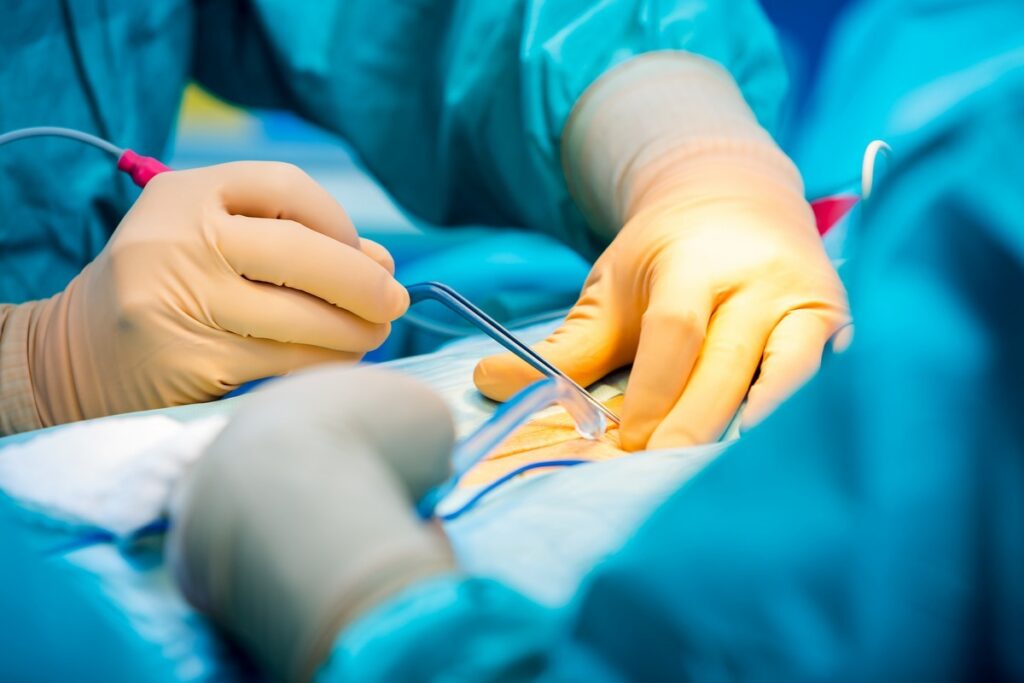 Для Бахмутської лікарні у Дніпрі купили електрохірургічний апарат за 108 тис. Навіщо він та чи з’явиться більше послуг
