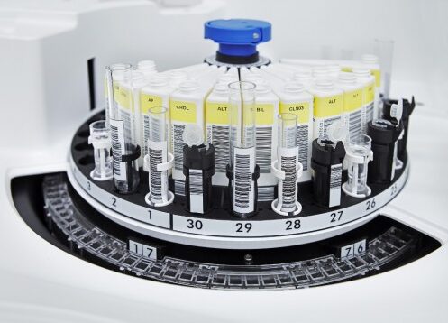 Родинська міська лікарня в Покровській громаді хоче купити біохімічний автоматичний аналізатор майже за півмільйона гривень (ДЕТАЛІ)