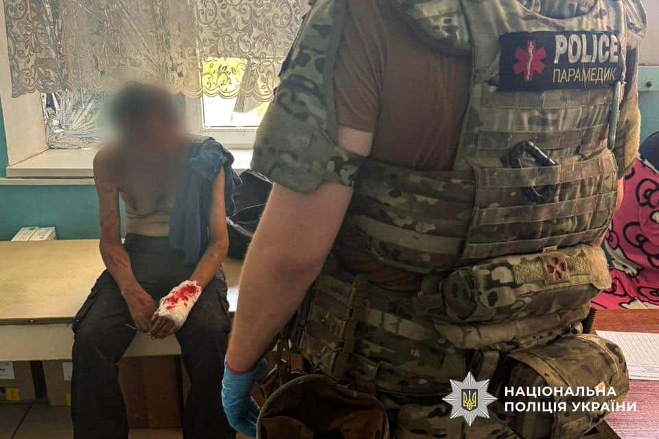 Цивільний, який 25 липня 2025 року дістав поранення у Донецькій області