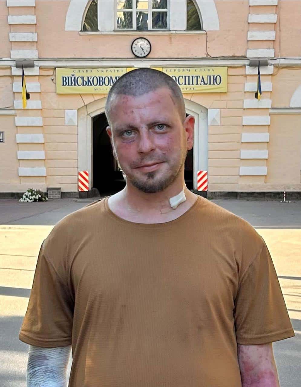 Зображення до посту: “Ангел-хранитель крыло обожгло, но сына защитил”. Мама раненого защитника из Донетчины — о реабилитации сына и первых шагах к выздоровлению