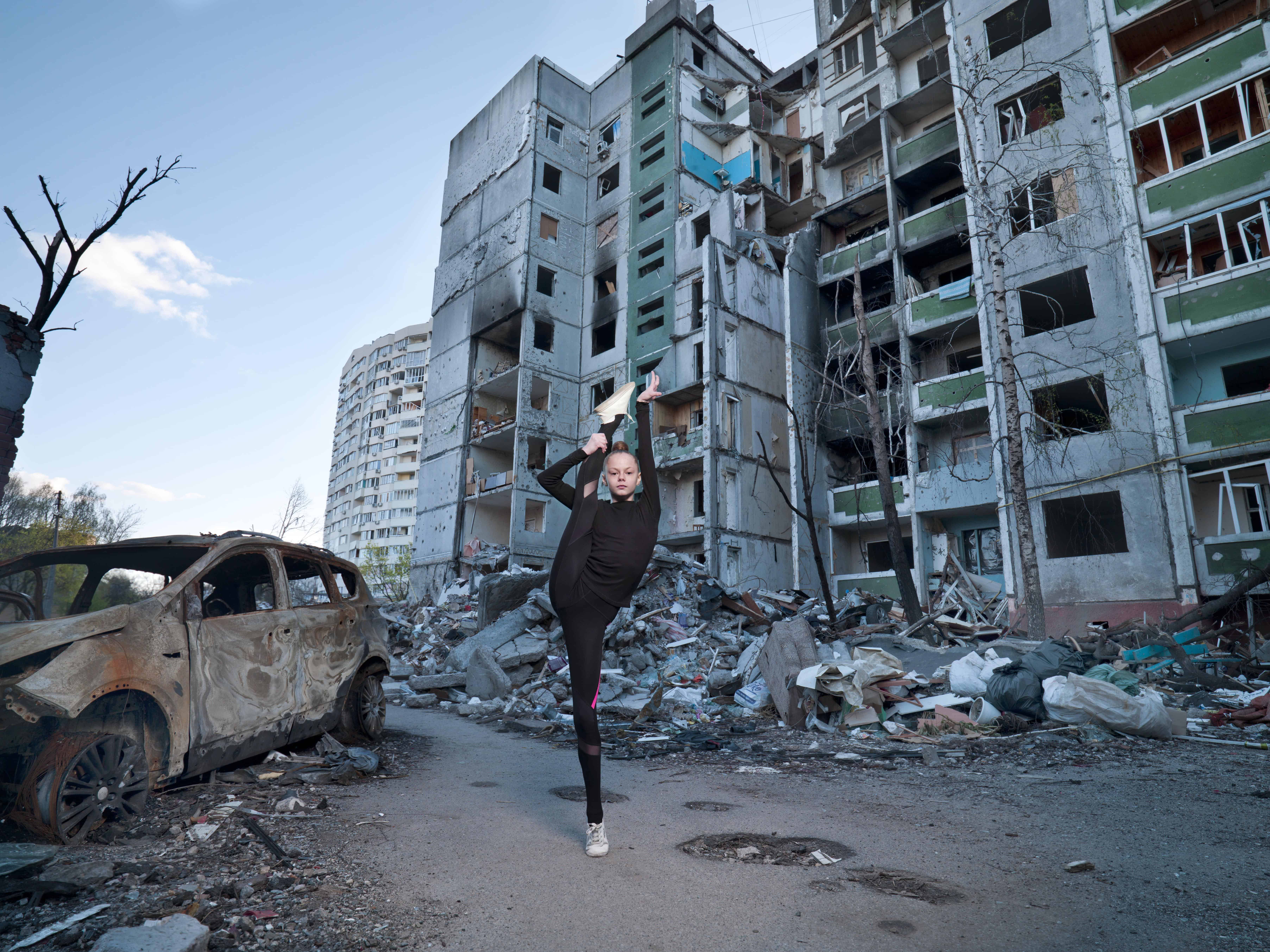 У Києві 19 листопада покажуть виставку "Те, що болить" про людей у війні: як долучитися