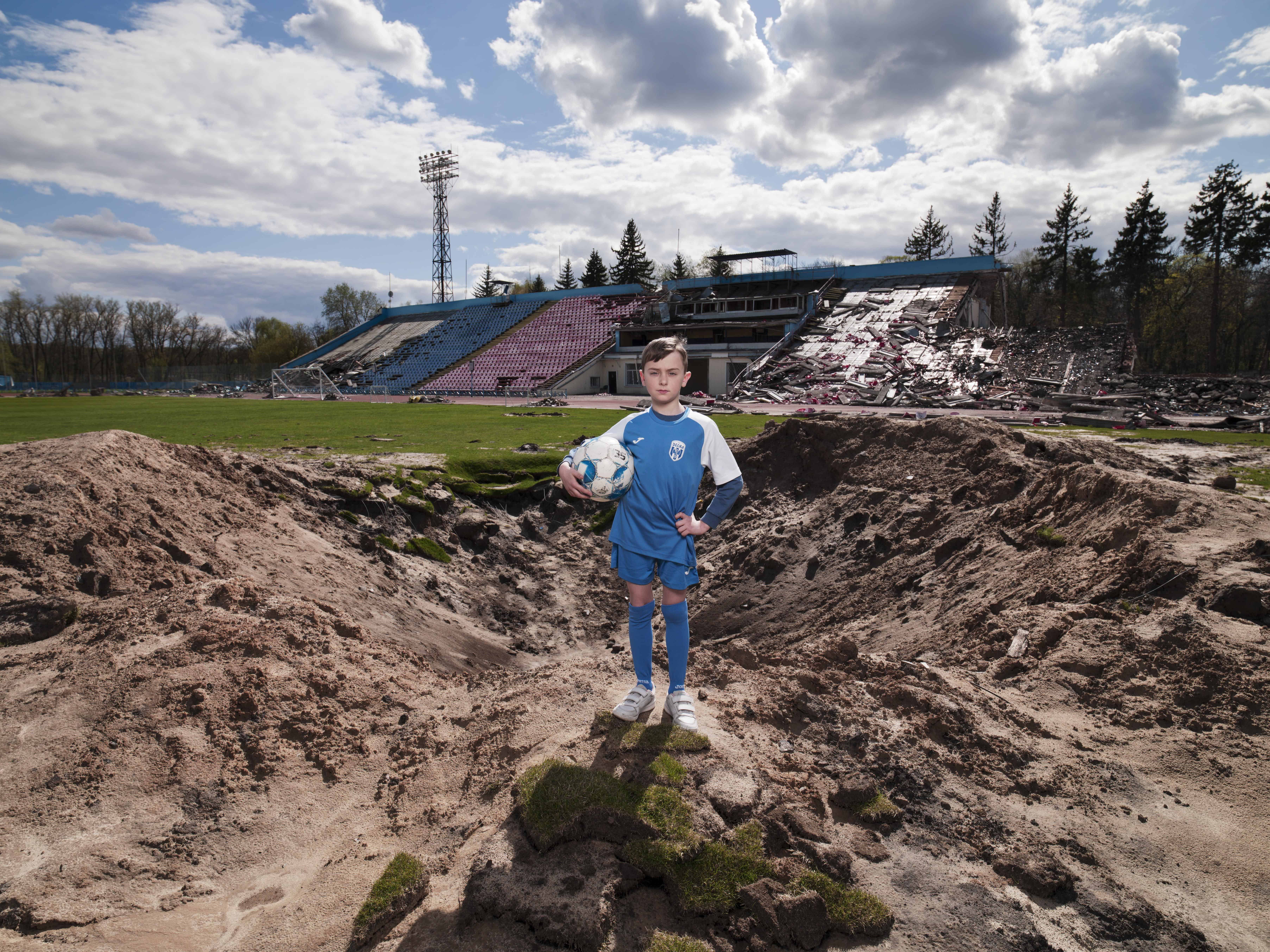 У Києві 19 листопада покажуть виставку "Те, що болить" про людей у війні: як долучитися