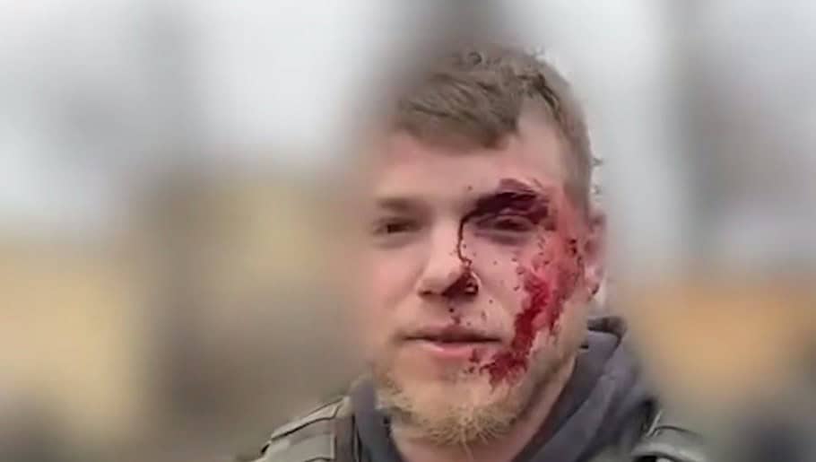 Під лиманом під обстріл потрапив американський волонтер