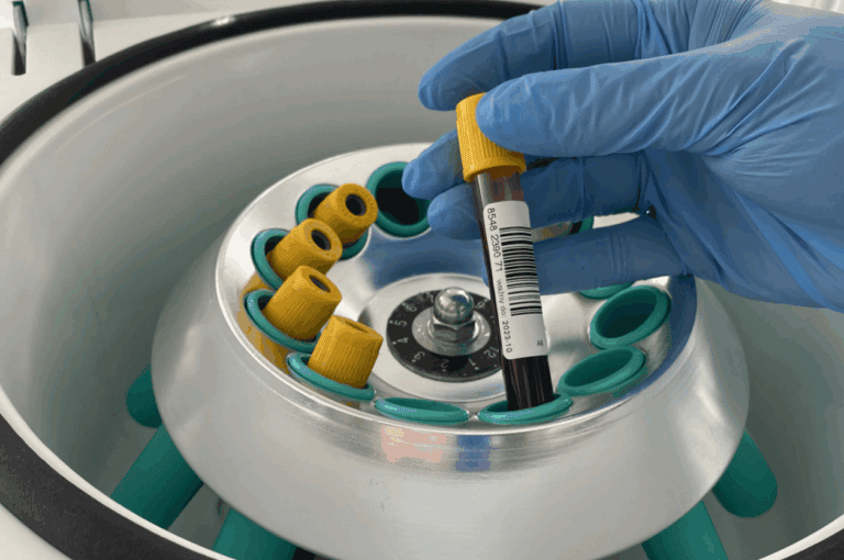 Скрининг здоровья для людей от 40 лет: в Селидово заказывают лабораторные анализы на 2 млн грн